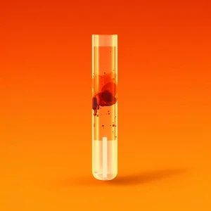Immunoglobulina IgG