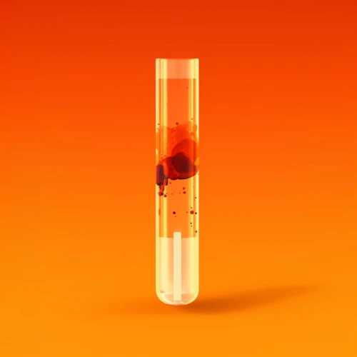 badanie_immunoglobulina_igg_poznan_neomedica.jpg