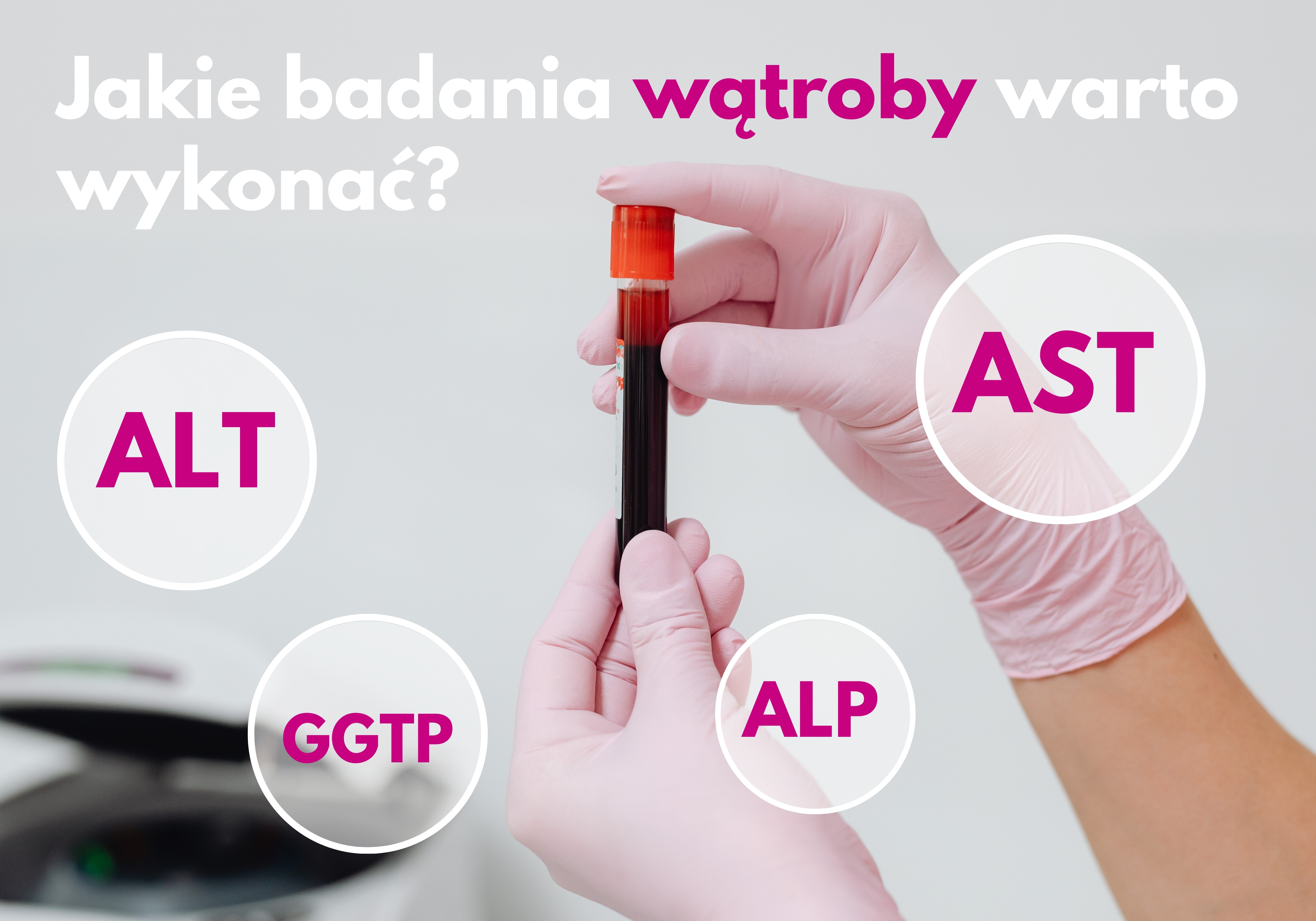 Podwyższone ALT, AST i GGTP – co oznaczają wyniki i jakie badania wątroby warto zrobić?